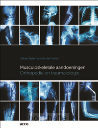 Musculoskeletale aandoeningen
