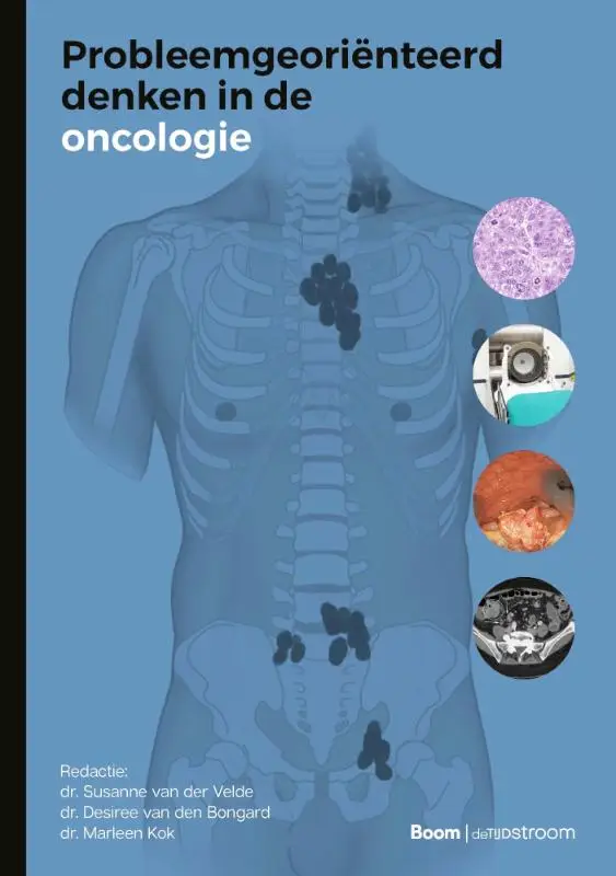 Probleemgeoriënteerd denken in de oncologie