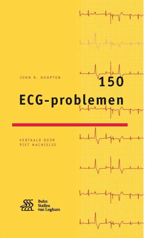 150 ECG-problemen