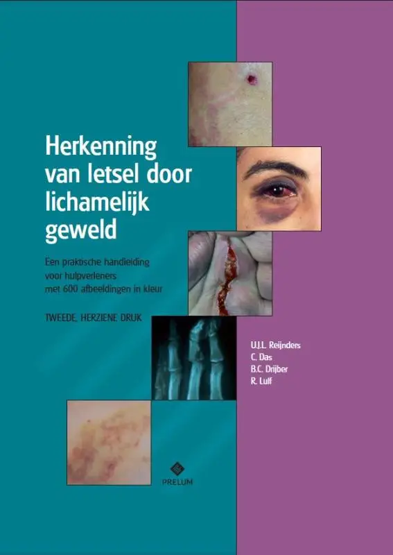 Herkenning van letsel door lichamelijk geweld
