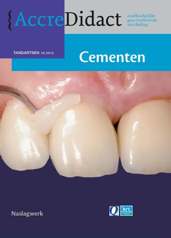Cementen