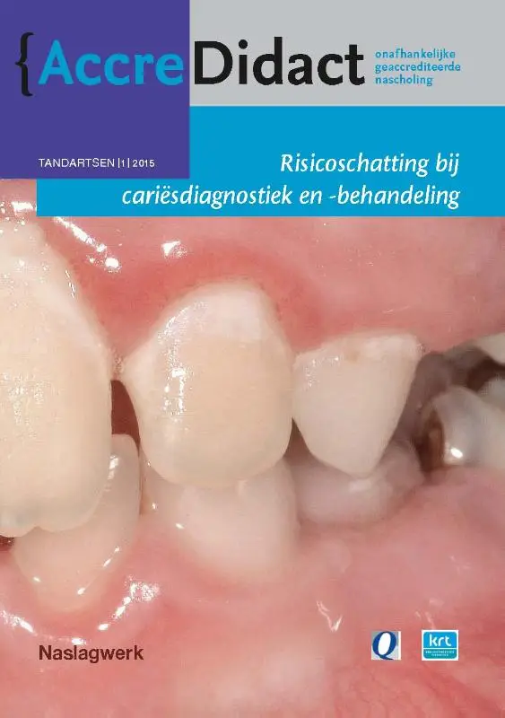 Risicoschatting bij cariësdiagnostiek en -behandeling gebaseerd op risicoschatting